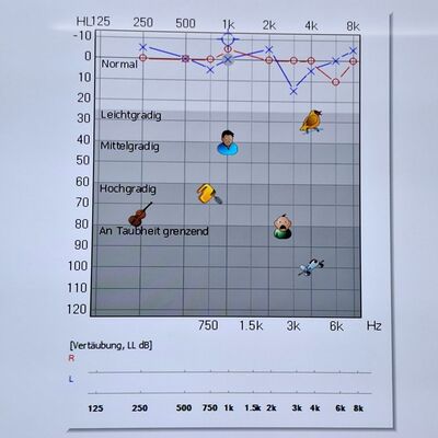 Ergebnisse eines H&ouml;rtests